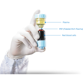 PRP-KIT