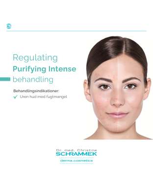 Regulating: Purifying Intense behandling