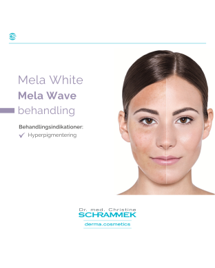 Mela White: Mela Wave behandling
