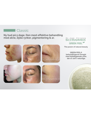 GREEN PEEL® - A4 skilt, liggende - Classic
