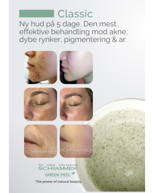 GREEN PEEL® Classic - A4 skilt, stående
