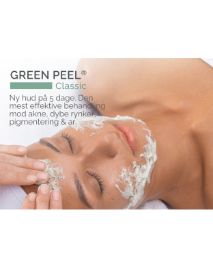 GREEN PEEL® - A4 skilt, liggende - Classic